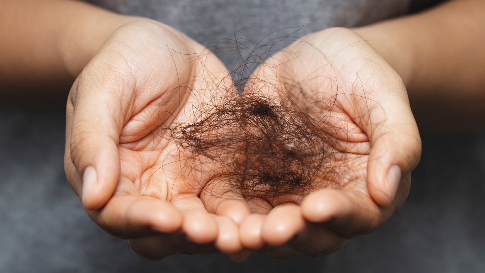 postpartum hair loss